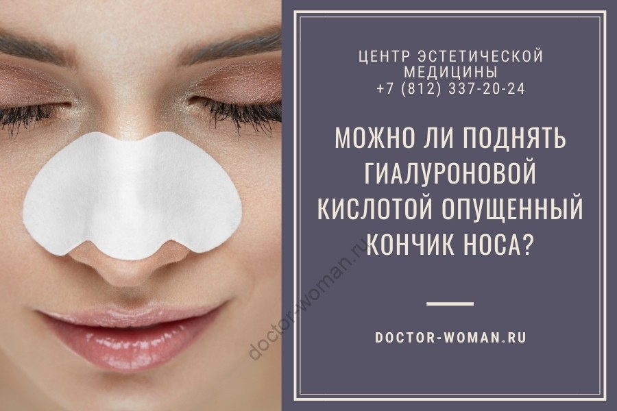 Можно ли поднять гиалуроновой кислотой опущенный кончик носа